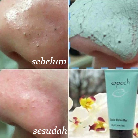 Epoch Glacial Marine Mud Sachet